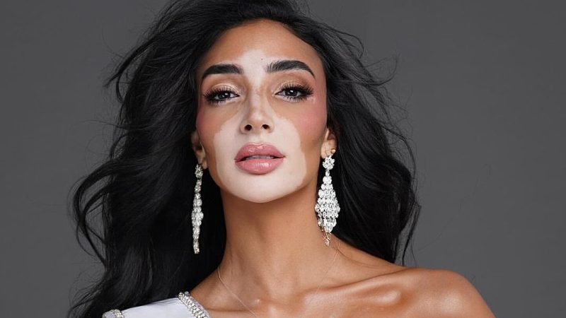 Hoa Hậu Hoàn Vũ Ai Cập – Thí Sinh Có Vẻ Đẹp Khác Lạ Ở Miss Universe 2024