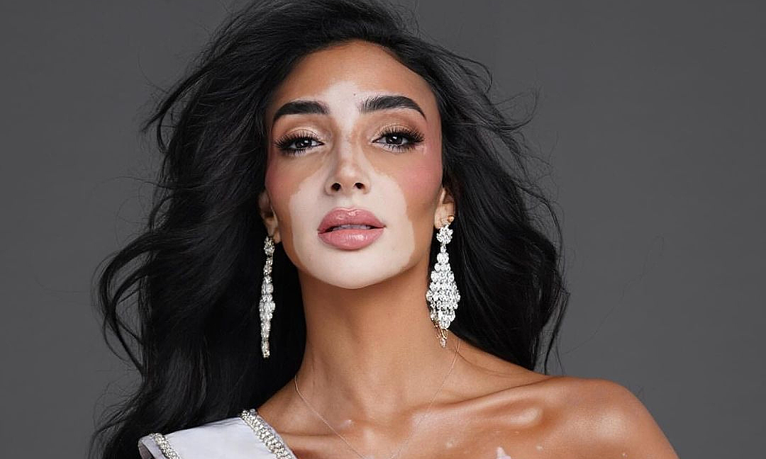 Hoa Hậu Hoàn Vũ Ai Cập – Thí Sinh Có Vẻ Đẹp Khác Lạ Ở Miss Universe 2024