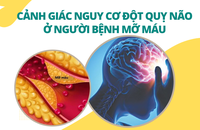 Cảnh Giác Nguy Cơ Đột Quỵ Não Ở Người Bệnh Mỡ Máu Cùng Nattospes